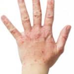 health benefits of fulvic acid for skin rashes