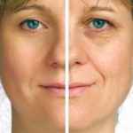 benefits of collagen peptides for skin